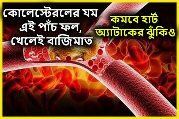 এই ৫ ফলই কোলেস্টরলের যম! প্রতিদিন খেলেই বাজিমাত, শরীর সুস্থ, কমবে হার্ট অ্যাটাক