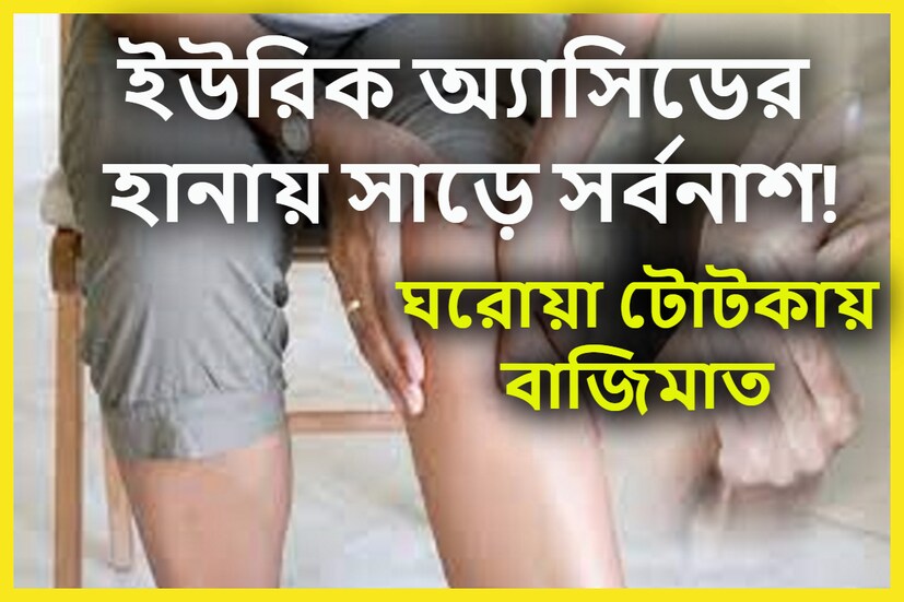 High Uric Acid: হঠাৎ হঠাৎ করে হাত পায়ে যন্ত্রণা হলে হালকা ভাবে নেওয়া কখনই উচিৎ নয় ৷ হতে পারে ইউরিক অ্যাসিড বাসা বাঁধছে শরীরে ৷ প্রতীকী ছবি ৷