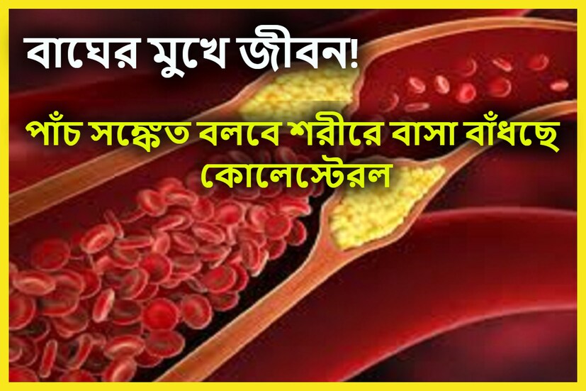 হাই কোলেস্টরল অত্যন্ত গম্ভীর একটি রোগ ৷ অনেকেই আছেন শুরুর দিকে হাই কোলেস্টেরল বৃদ্ধির টের পাননা ৷ প্রতীকী ছবি ৷