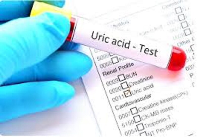 High Uric Acid: শরীরে ব্যাপক পরিমাণে ইউরিক অ্যাসিডের বাড়বাড়ন্ত হলে বেশ কয়েকটি ঘরোয়া টোটকা প্রয়োগ করতে হবে ৷ প্রতীকী ছবি ৷
