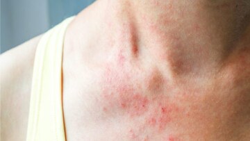 প্রতীকী