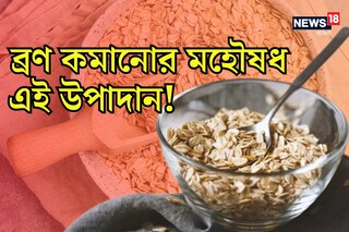 নিমেষে ব্রণ তাড়াবে রান্নাঘরের এই উপাদান! চট জলদি গ্লো আনতেও অতুলনীয়, জেনে নিন