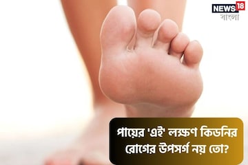 আপনার শরীরে কি Kidney-র রোগ বাসা বাঁধছে? বুঝে নিন 'এই' লক্ষণ দেখে! আপনার শরীরে কি Kidney-র রোগ বাসা বাঁধছে? বুঝে নিন 'এই' লক্ষণ দেখে!
