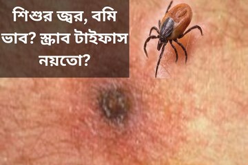 শিশুর