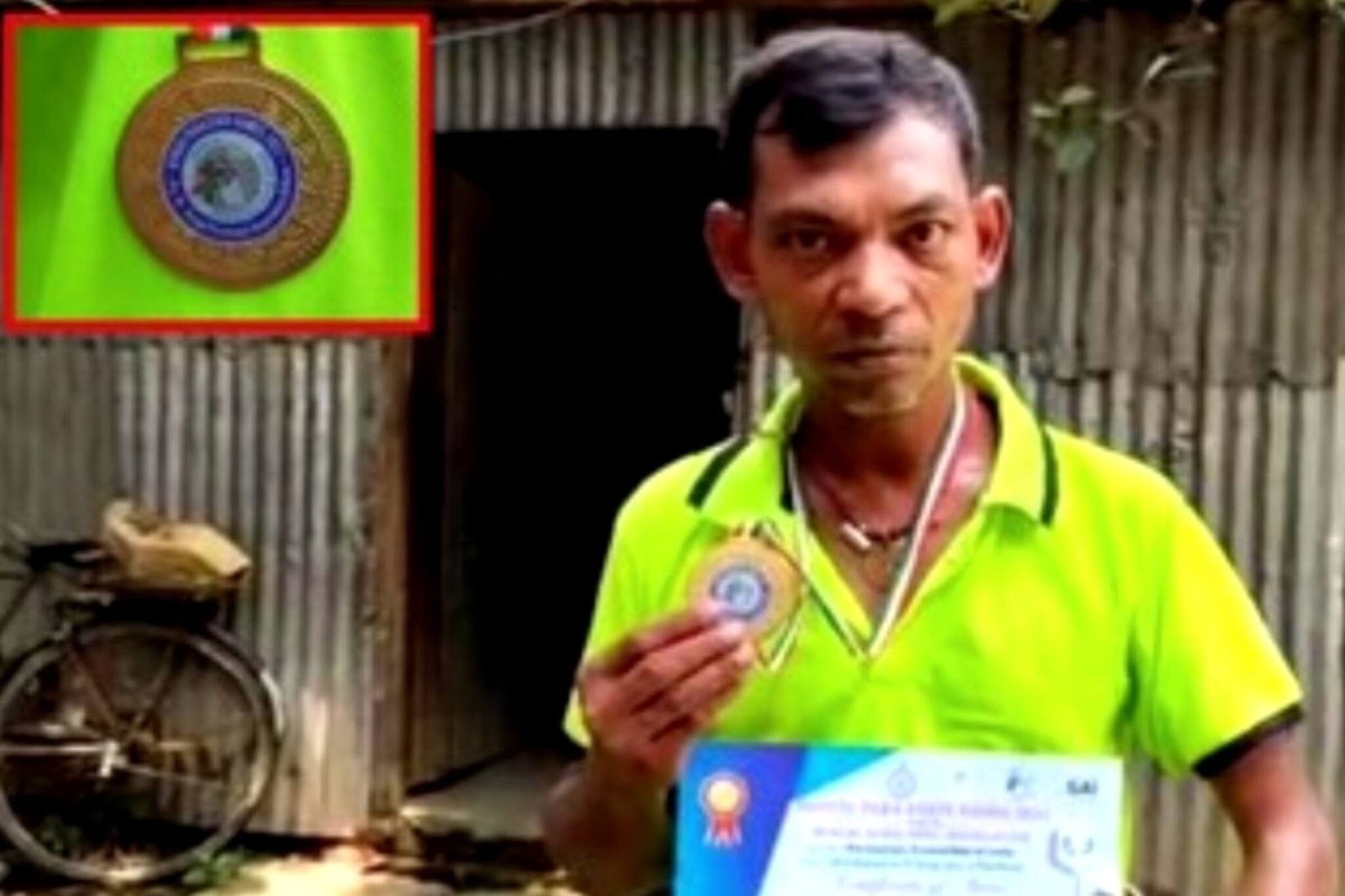 দারিদ্রের সঙ্গে লড়াই, সঙ্গে শারীরিক সমস্যা! তবুও এক নম্বর এই খেলোয়াড়