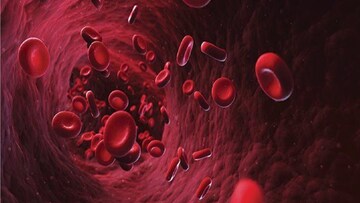 অ্যানিমিয়া।