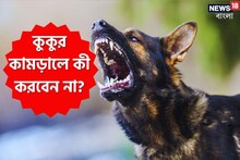 কুকুর কামড়ালে প্রথমেই কী করবেন না জানুন, ভয় না পেয়ে এই কাজগুলি করুন