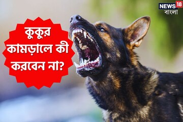 কুকুর কামড়ালে প্রথমেই কী করবেন না জানুন, ভয় না পেয়ে এই কাজগুলি করুন