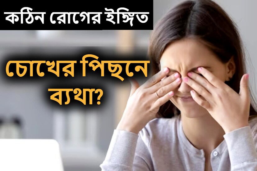 বাঁকুড়া: প্রচন্ড জ্বর এসেছে আপনার? কি করবেন বুঝতে পারছেন না? ডেঙ্গি- ম্যালেরিয়া নাকি স্কার্ব টাইফাস ? এইসব প্রশ্ন শুধু আপনার একার হচ্ছে এমনটা নয়। (প্রতীকী ছবি)