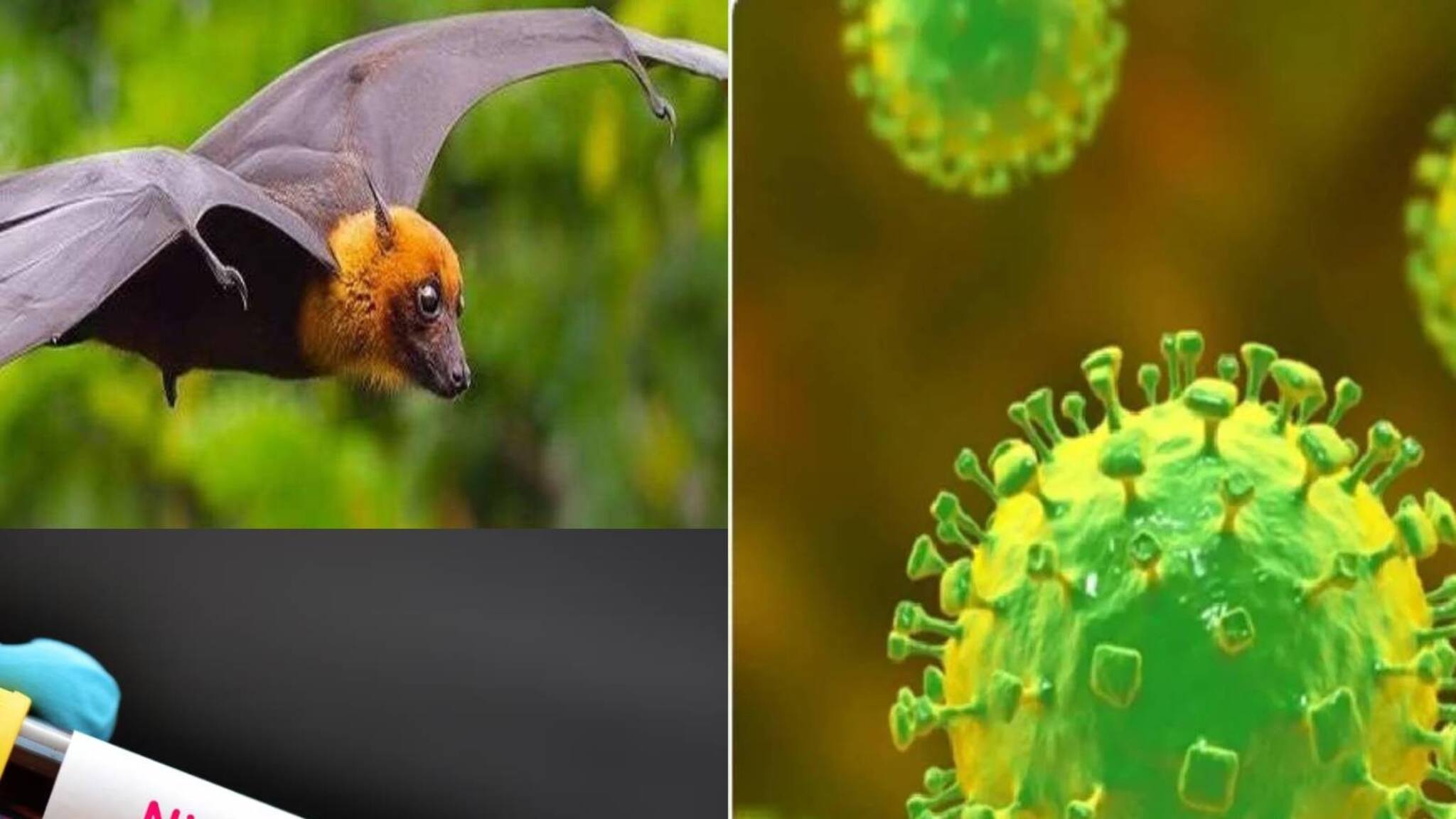 Nipah Virus Symptoms: কেরলে ভয়ঙ্কর ভাইরাস নিপা নিয়ে ছড়াচ্ছে আতঙ্ক! শরীরে এই উপসর্গ দেখা দিলেই সতর্কতা নিন