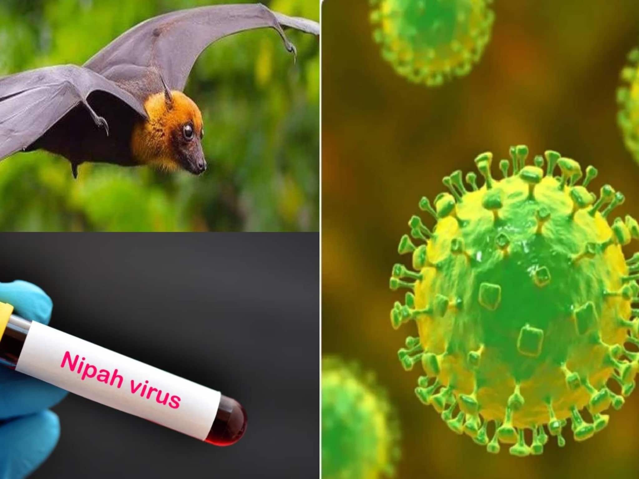 Nipah Virus Symptoms: কেরলে ভয়ঙ্কর ভাইরাস নিপা নিয়ে ছড়াচ্ছে আতঙ্ক! শরীরে এই উপসর্গ দেখা দিলেই সতর্কতা নিন