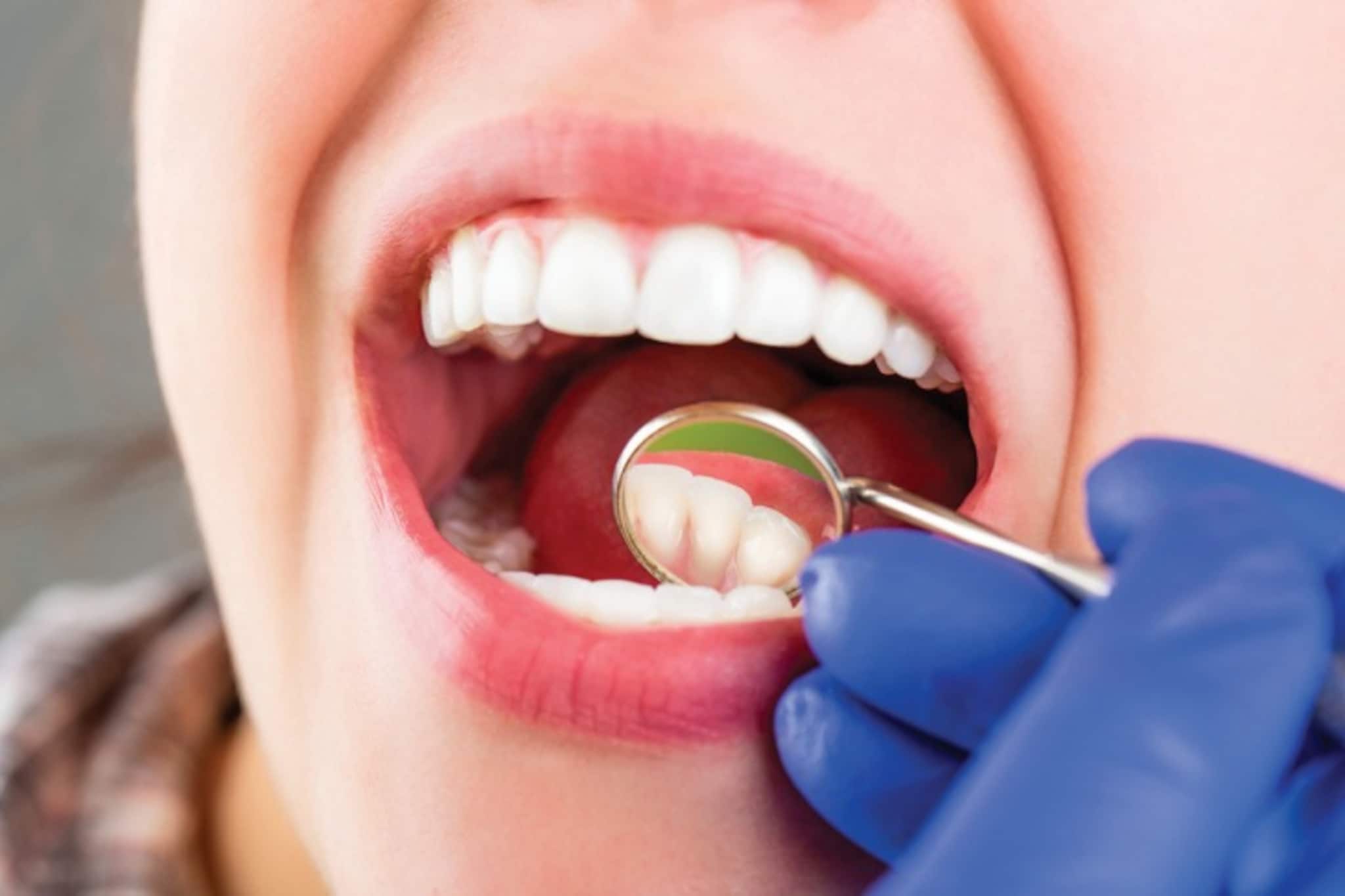 Oral Cancer: হাতে রাখুন মাত্র ২ মিনিট, মুখের ক্যানসার কীভাবে প্রতিরোধ করা সম্ভব, জেনে নিন বিশেষজ্ঞের কাছ থেকে