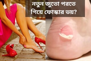পুজোতে নতুন জুতো পরতে গিয়ে ফোস্কার ভয়? রইল ঘরোয়া সমাধান