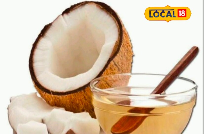 শীতকালে ত্বকের মধ্যেকার জলীয়ভাগ কমে যাওয়ার ত্বক ফেটে যেতে পারে। সেক্ষেত্রে নারিকেল তেল যেকোন ক্রিমের থেকে বেশি উপকারী।