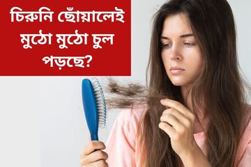 চিরুনি ছোঁয়ালেই মুঠো মুঠো চুল পড়ছে? রেহাই পেতে মনে রাখুন বিশেষজ্ঞের এই টিপস চিরুনি ছোঁয়ালেই মুঠো মুঠো চুল পড়ছে? রেহাই পেতে মনে রাখুন বিশেষজ্ঞের এই টিপস