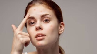 সমস্যা থেকে মুক্তি পেতে ঘরোয়া টোটকা ব্যবহার করা যেতে পারে