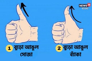 আপনার বুড়ো আঙুল সোজা না ব্যাঁকা?