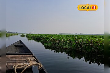 পেটের