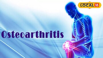 প্রতীকী