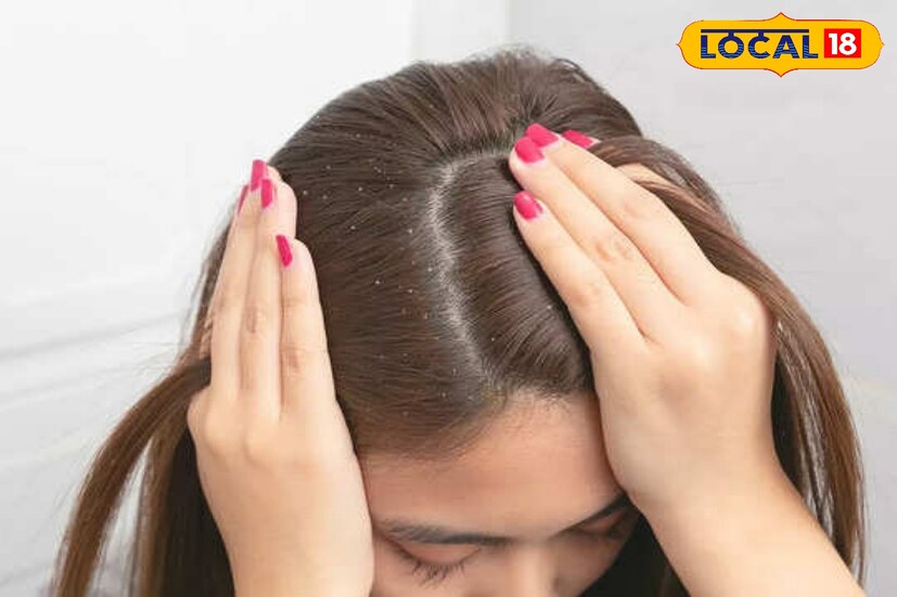 এই হেয়ার প্যাক চুলে ও স্ক্যাল্পে ভালোকরে লাগিয়ে নিতে হবে। ১ ঘণ্টা রেখে শ্যাম্পু করে ফেলুন। কন্ডিশনার ও হেয়ার সিরাম লাগিয়ে চুল ধুয়ে ফেলুন।