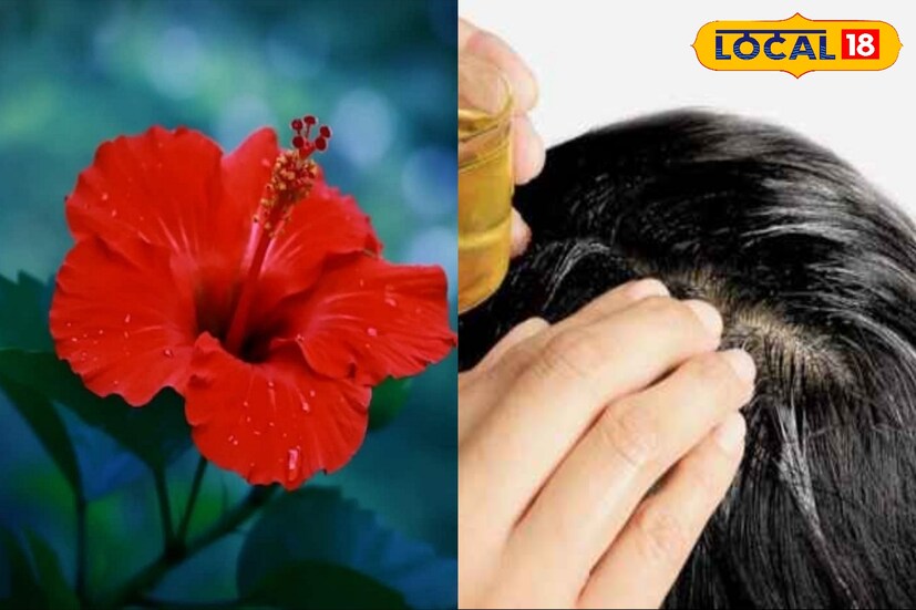 জবা ফুলে আছে উপকারী ভিটামিন সি। এই ভিটামিন সি-এর ঘাটতি চুল পড়ার অন্যতম কারণ। তাই চুলের যত্নে জবা ফুল ব্যবহার করলে এই ভিটামিনের ঘাটতি কমে। স্বাভাবিকভাবেই চুল পড়ার সমস্যাও কমতে থাকে। 