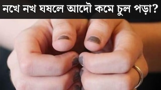 নখে নখ ঘষলে আদৌ কমে চুল পড়া? আসল সত্যি জানালেন বিশেষজ্ঞ নখে নখ ঘষলে আদৌ কমে চুল পড়া? আসল সত্যি জানালেন বিশেষজ্ঞ