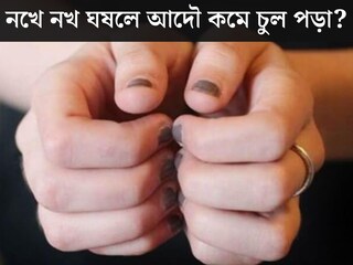 নখে নখ ঘষলে আদৌ কমে চুল পড়া? আসল সত‍্যি জানালেন বিশেষজ্ঞ