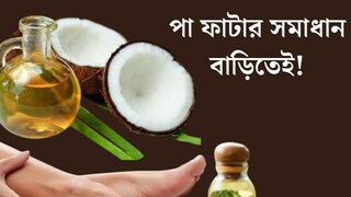 পা ফাটা নিয়ে চিন্তায়? নারকেল তেল দিয়ে বাড়িতেই বানিয়ে ফেলুন ফুট ক্রিম! তুলতুলে হবে চামড়া