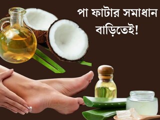 পা ফাটা নিয়ে চিন্তায়? নারকেল তেল দিয়ে বাড়িতেই বানিয়ে ফেলুন ফুট ক্রিম! তুলতুলে হবে চামড়া