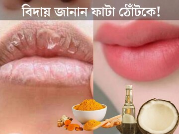 এই শীতে বিদায় জানান ফাটা ঠোঁটকে! খরচ ভুলে যান, সমাধান আছে রান্নাঘরেই