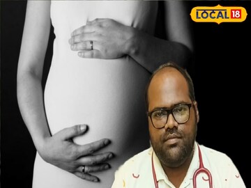 পিসিওডি