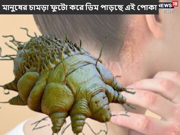 মানুষের চামড়া ফুটো করে ডিম পাড়ছে এই পোকা! ভয়ঙ্কর রোগ ছড়াচ্ছে উত্তরপ্রদেশে