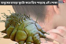 মানুষের চামড়া ফুটো করে ডিম পাড়ছে এই পোকা! ভয়ঙ্কর রোগ ছড়াচ্ছে উত্তরপ্রদেশে