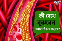 শরীরে Cholesterol বাসা বাঁধছে না তো...? কী দেখে বুঝবেন? চিনে নিন 'এই' লক্ষণগুলি!