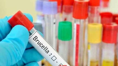 ব্রুসেলোসিসে আক্রান্ত হয়ে রাজ্যে আরও একজনের মৃত্যু ব্রুসেলোসিসে আক্রান্ত হয়ে রাজ্যে আরও একজনের মৃত্যু