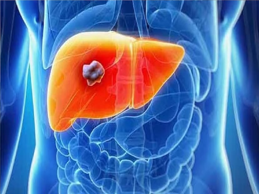 *লিভারের রোগে উপকারী: ধনেপাতা লিভার সংক্রান্ত সমস্যায় খুবই উপকারী বলে মনে করা হয়। ধনে পাতা অ্যালকালয়েড এবং ফ্ল্যাভোনয়েড সমৃদ্ধ। এই উপাদানগুলো জন্ডিসের মতো লিভারের রোগ সারাতে সাহায্য করে। সংগৃহীত ছবি। 