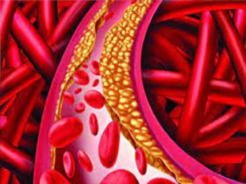 *রক্তে শর্করার মাত্রা কমায়: খাবারে ধনেপাতা ব্যবহার করলে শরীরের এনজাইম সক্রিয় হয়ে ওঠে, যা শরীরে রক্তের শর্করাকে নিয়ন্ত্রণে রাখতে সাহায্য করে। এতে শরীরে সুগার নিয়ন্ত্রণে থাকে, ডায়াবেটিস কাছে ঘেঁষতে পারে না। সংগৃহীত ছবি।