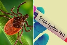 জলপাইগুড়িতে স্ক্রাব টাইফাসের হানা, মোট আক্রান্ত ১২৯ জন