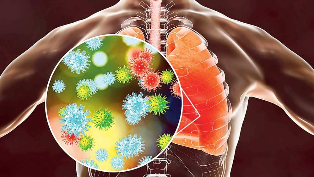 চাইনিজ ওয়াকিং নিউমোনিয়া-য় কোনও একটি ভাইরাস নয়, একাধিক ভাইরাসের প্রভাবে সংক্রমণ দেখা দিচ্ছে। যেমন, সার্স-কোভিড টু, প্যারাইনফ্লুয়েঞ্জা, এইচনাইনএনটু, রেসপিরেটরি সিনিক্যাল ভাইরা, মাইকোপ্লাজমা নিউমোনিয়া ভাইরাসের সম্মিলিত সংক্রমণ দেখা যাচ্ছে রোগীর শরীরে। কী কী উপসর্গ দেখা দিলে সাবধান হবেন?