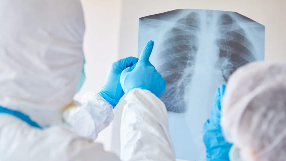 নিউমোনিয়া হল লাং-এর সংক্রমণ যা এক বা দুটি লাং-কেই সংক্রমিত করে।Mycoplasma pneumonia-র মতো ব্যাকটেরিয়ার সংক্রমণে নিউমোনিয়া হয় । ভাইরাসের সংক্রমণেও নিউমোনিয়া হয়। ভাইরাসগুলি হল-- RSV- respiratory syncytial virus, Adenovirus, Influenza, Rhinovirus, COVID। নিউমোনিয়ায় ভাইরাস বা ব্যাকটেরিয়ার সংক্রমণে এয়ার স্যাক বা অ্যালভিওলি ফ্লুইড বা পাসে ভর্তি হয়ে যায়। 