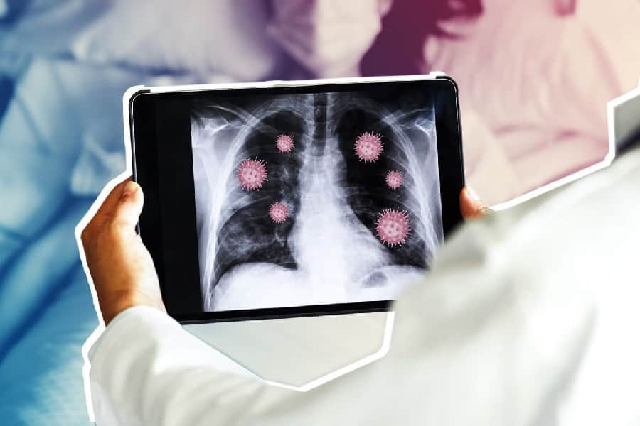 নিউমোনিয়ার প্রধান লক্ষণ অস্বাভাবিক জ্বর। শিশুর জ্বর যদি ক্রমশ বাড়তে থাকে এবং কিছুতেই না কমে, তখন অবশ্যই সতর্ক হতে হবে। জ্বরের সঙ্গে কাশিও হবে, বুকে ব্যথাও হবে। নিউমোনিয়ার ক্ষেত্রে শ্বাসকষ্টও হয়। 