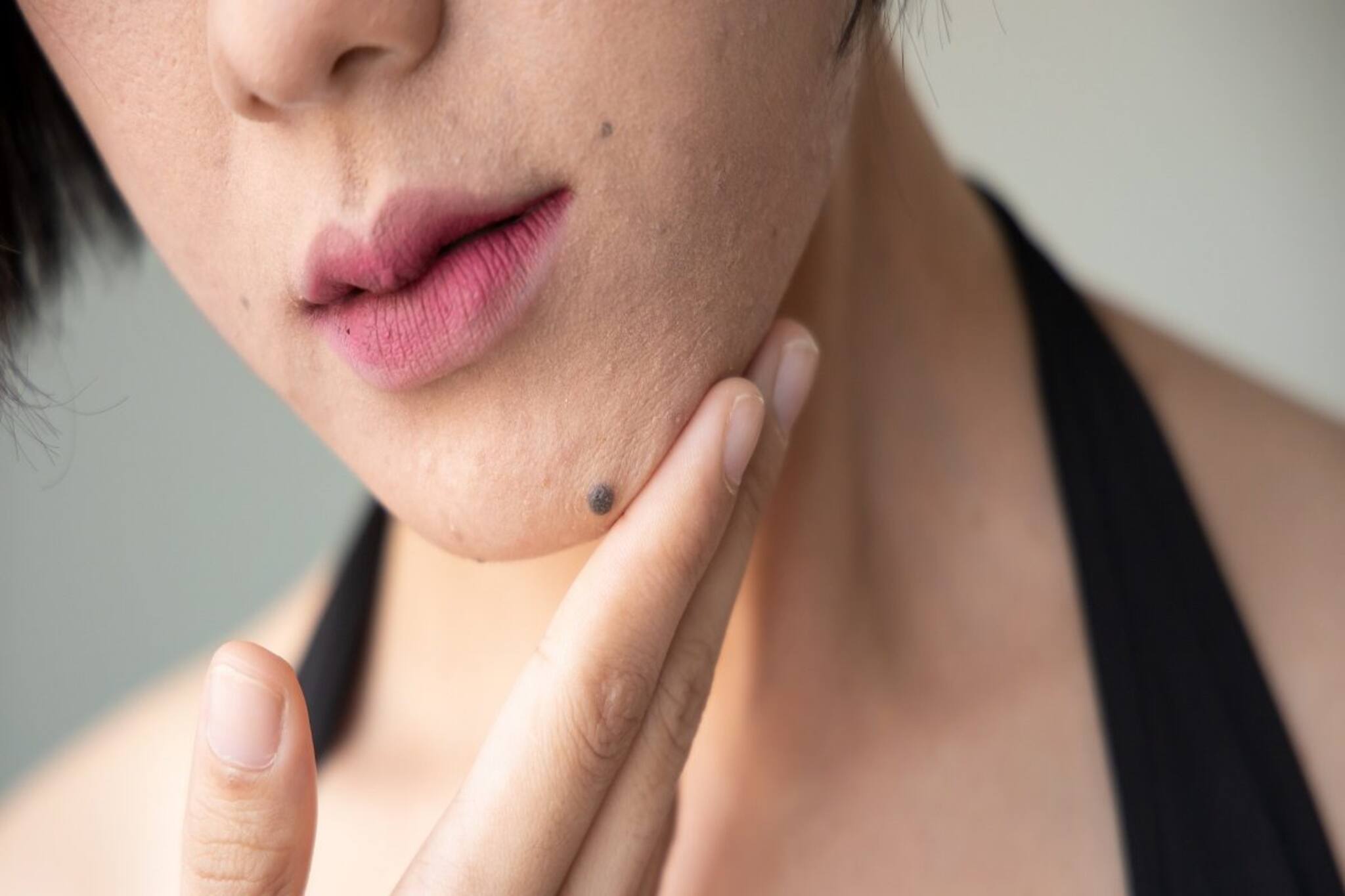 আপনার শরীরের কোথায় তিল রয়েছে? দেহের এই অংশগুলিতে তিল থাকলে সৌভাগ্য রোখা যাবে না!