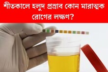 শীতকালে হলুদ প্রস্রাব! কোনও মারাত্মক রোগের লক্ষণ নয় তো? জানুন চিকিৎসকের মত