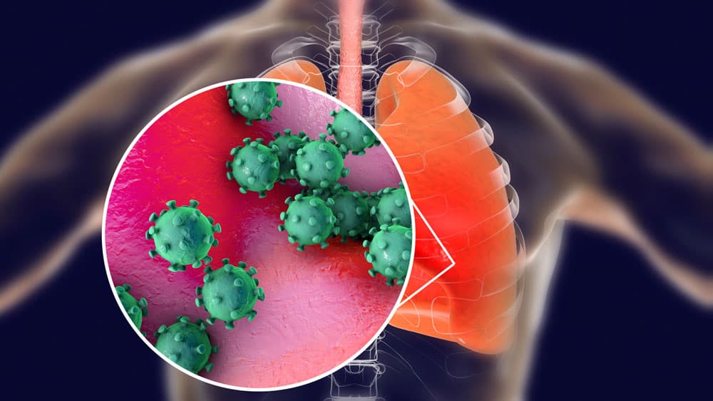 চাইনিজ নিউমোনিয়ায় ফুসফুসে গভীর সংক্রমণ, সঙ্গে সর্দিকাশি, জ্বর এবং শ্বাসকষ্টে ভুগছে বাচ্চারা। ভর্তি করতে হচ্ছে হাসপাতালেও। প্রধান উপসর্গ হল খুব জ্বর, গলায় ব্যথা, মাইয়ালগিয়া, ক্লান্তি। শিশুদের ক্ষেত্রে প্রচণ্ড কাশি ও শ্বাসকষ্ট-ও দেখা দিতে পারে। বমি ও ডায়ারিয়ার সমস্যাও দেখা যাচ্ছে