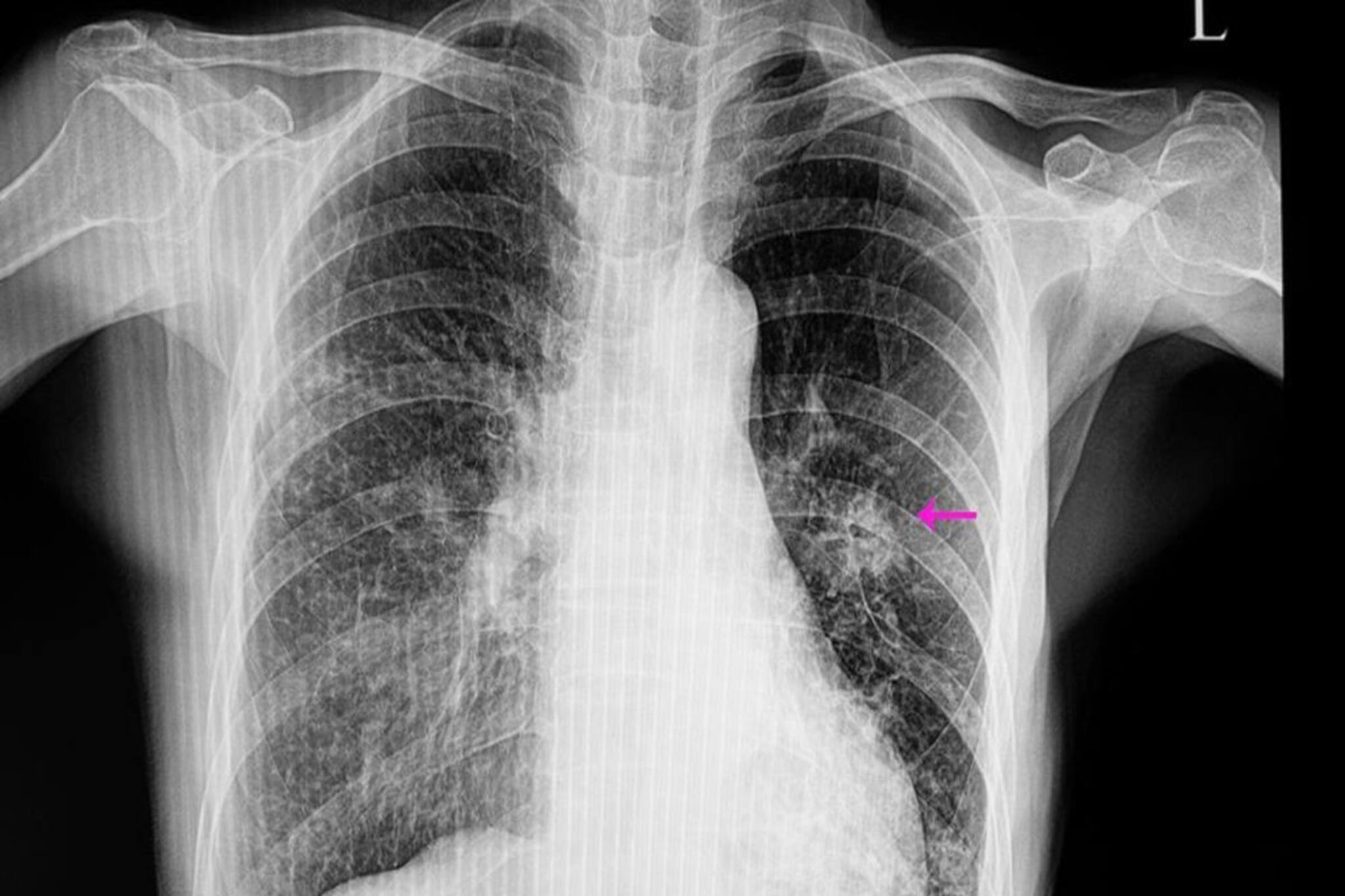 ধারেকাছে ঘেঁযবে না সর্দি-কাশি-নিউমোনি