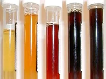 হলুদ, সবুজ, বাদামী না লাল? আপনার প্রস্রাবের 'এই' ৬ রং বলে দেবে স্বাস্থ্য কেমন! হলুদ, সবুজ, বাদামী না লাল? আপনার প্রস্রাবের 'এই' ৬ রং বলে দেবে স্বাস্থ্য কেমন!