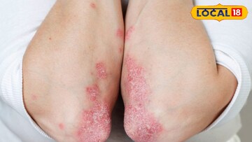 প্রতিকী