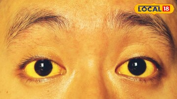 প্রতিকী