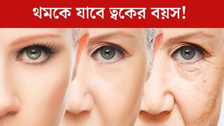 বয়স কমতে পারে ১০ বছর! ২০-তেই রুখতে চান ত্বকের বয়স? উধাও হবে বলিরেখা, ডায়েটে শুধু এইসব খাবার