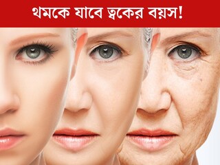 বয়স কমতে পারে ১০ বছর! ২০-তেই রুখতে চান ত্বকের বয়স? উধাও হবে বলিরেখা, ডায়েটে শুধু এইসব খাবার